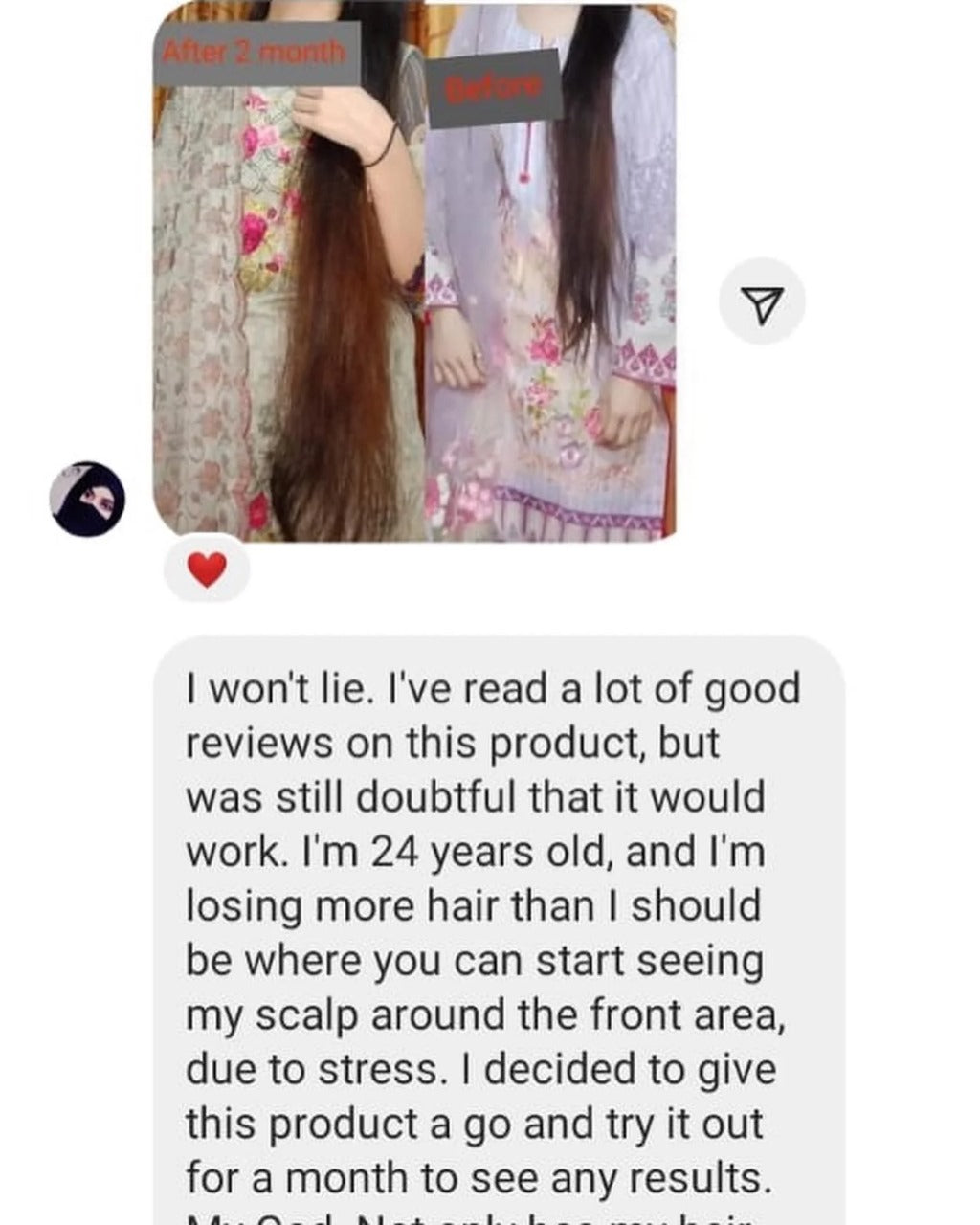 Herbal Onion Hair Growth Oil- 200 ml