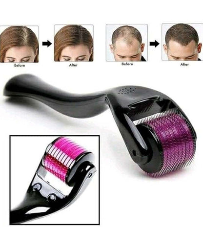 Derma Roller