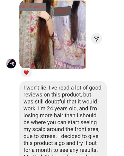 Herbal Onion Hair Growth Oil- 200 ml